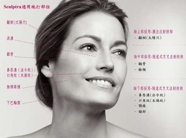 舒顏萃Sculptra® 圖片 7